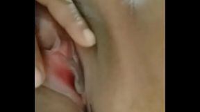 Mi nalguita en el hospital