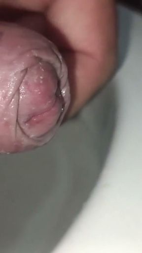 The silver of my penis is not coming up   Clip 1