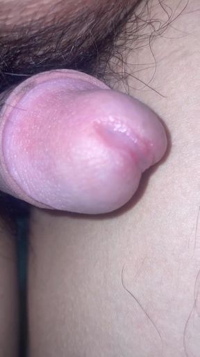 Massage the prostate and urethral bulb fluid.