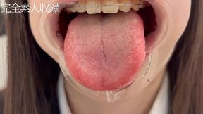 [Amateur | Oral Fetish] 18-Year-Old (156cm) with Braces & Silver Fillings â€“ First Checkup with a Slightly Bratty Attitude