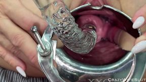 Glass Dildo Cervix Penetration