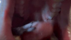 Bry Swallows Dentist- MP4