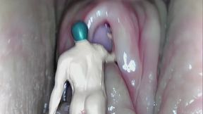 Unbirth (All Parts: 1, 2, 3)