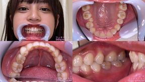 Shion Yumi - Watching Inside mouth of Japanese cute girl - MOV