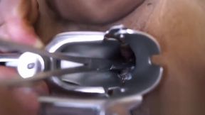 Mouth To Cock Resuscitation