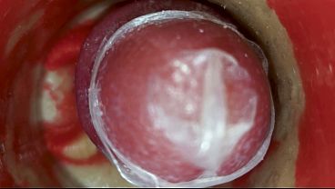 The camera inside the deep pussy records a huge ejaculation with a stuck condom