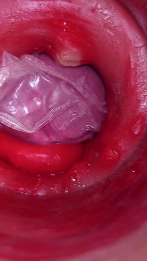 Unforgettable moment from &quot;The camera inside the deep pussy records a huge ejaculation with a stuck condom!&quot;