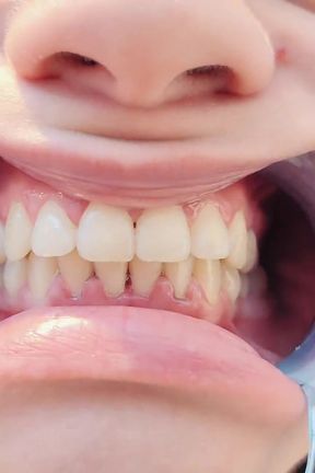 4K Dental Hygienist Routine Mouth Fetish Closeups Naked