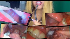 You're trapped inside my stomach (endoscope)