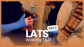 LATS Day 2 - Waking Up in two arm casts