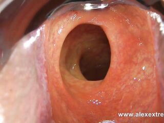 Incredible unfathomable anal view with XO speculum and light in Hotkinkyjo booty