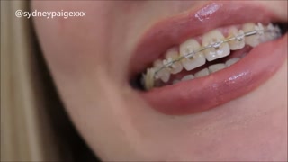Sydney Paige Teases You to Cum All Over Her Braces