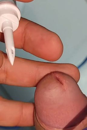 Extreme Insertion Into the Glans of the Pointed Straw.