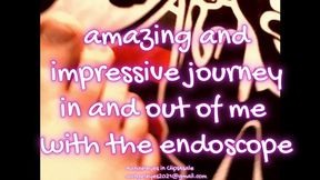 AMAZING AND IMPRESSIVE JOURNEY!! in and out of me with the endoscope