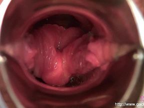 Gachig Gachip - Gachip 104