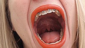 Blondie Yawning With Braces! MP4