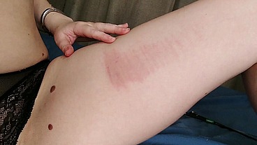 More misery stick fun as I try to make a beautiful pink and red gradient on my thigh
