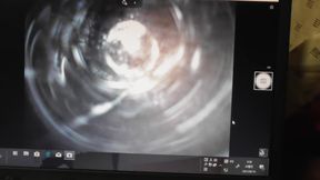 I looked into the hole in my butt with an endoscope.