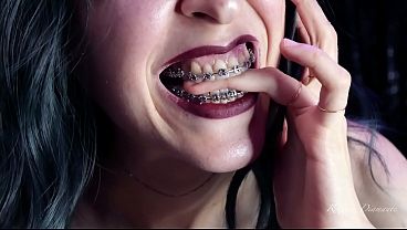 Biting my own fingers - bite, mouth, teeth, braces, fetish ITA