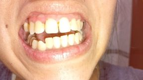 Lola's dirty, defective mouth