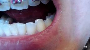 16 minutes my teeth canines to cam No sound No audio mp4