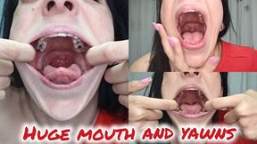 Huge mouth and yawns