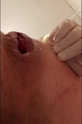 Prolapse Close-Up Compilation