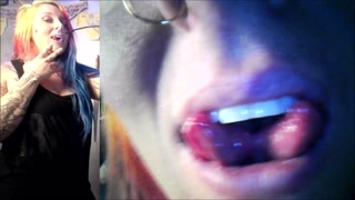 Vore Endoscopy