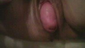 Freaky uterine prolapse of my mature white housewife