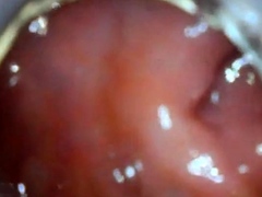 anal endoscope ass play from inside