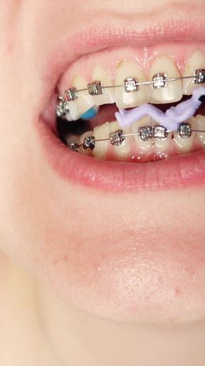 Giantess Devour Fetish in Braces