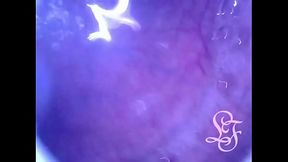 Pumping Air into my full Bladder with the Minicam inside