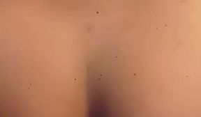 msaoi 1