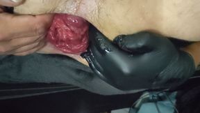 Huge egg play and prolapse pump