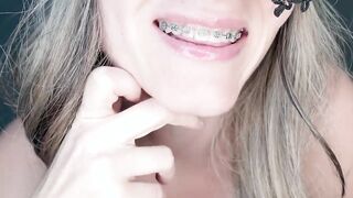 Joi for braces