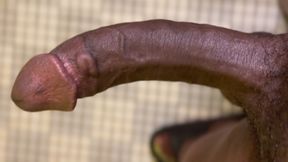 Jumpy Dick