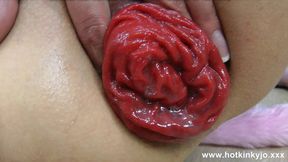 Gape-Devouring Bimbo Whores Out Anal&#x1F44C; Fisting Frenzy With Prolapse Perverts