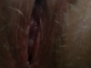 Blaire peeing post op