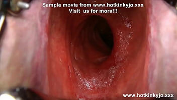 Anal gape and belly bulge with a gigantic speculum