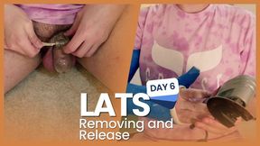 LATS DAY 6 - Removing and Release