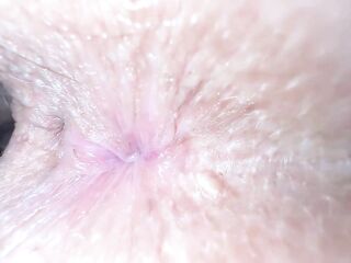 A beauty worries that her heavily pigmented anal looks impure even when it's clean Is this true?