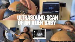 Ultrasound scan of an alien baby
