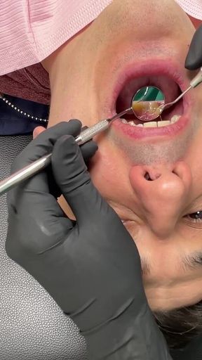 Nurse Bunny Checks Dr. Canada's Teeth Multi Angle