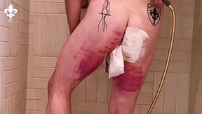 1 day after a judicial caning