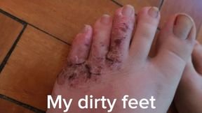 Dirty Toenails After Days Without Care – Chewed Nails, Natural Build-Up, Close-Up of Real Feet Neglect Fetish
