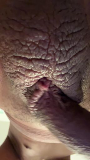 Penis and areolas