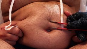 Clinical Insertion: Deep Bellybutton Exam