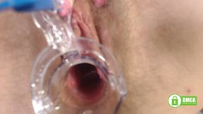 Gyno exam with speculum close up in hairy pussy