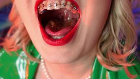 EATING BLOWING CANDY - ASMR VIDEO OF CHEWING GIRL IN BRACES WITH ALL