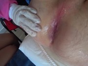 DAY 6.1: The nurses almost fought over my dick and ass. Public Crazy Place in hospital
